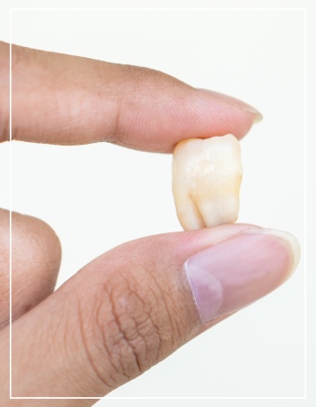 Broken Tooth Near Me in Beverly Hills, CA