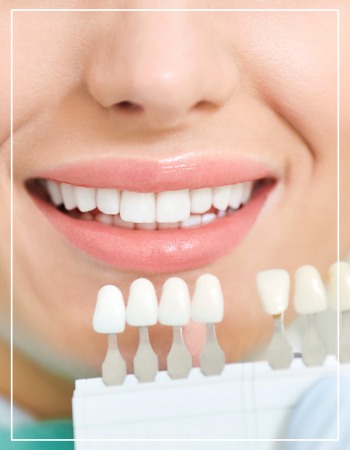 Dental Crowns Near Me in Beverly Hills, CA
