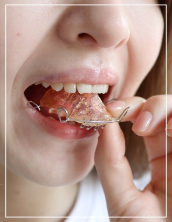 Retainer Removal Near Me in Beverly Hills, CA