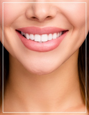 Veneers Near Me in Beverly Hills, CA