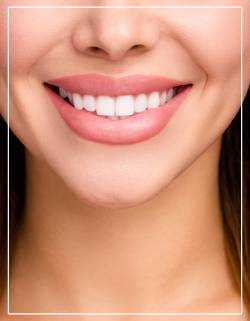 Veneers Near Me in Beverly Hills, CA