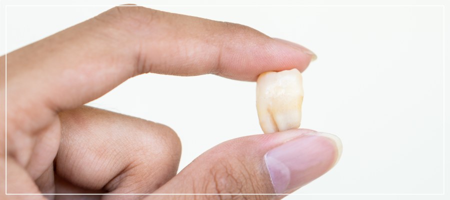 Broken Tooth Treatment Clinic in Beverly Hills, CA