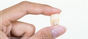 Broken Tooth Treatment Clinic in Beverly Hills, CA