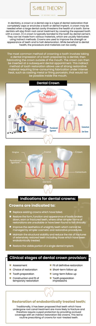 Common questions asked by patients: What is a dental crown? When do I need a dental crown? How long do dental crowns last? How long does it take to get a dental crown? For more information, contact us or schedule an appointment online. We are conveniently located at 99 North La Cienega Blvd, Suite 301, Beverly Hills, CA 90211.