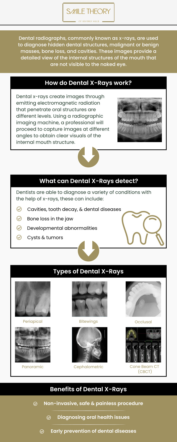 Common questions asked by patients: What is a dental X-ray? Why are dental X-rays necessary? How often should I get dental X-rays? Can I get dental X-rays while pregnant? For more information, contact us or schedule an appointment online. We are conveniently located at 99 North La Cienega Blvd, Suite 301, Beverly Hills, CA 90211.