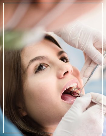Dental Filling Near Me in Beverly Hills, CA
