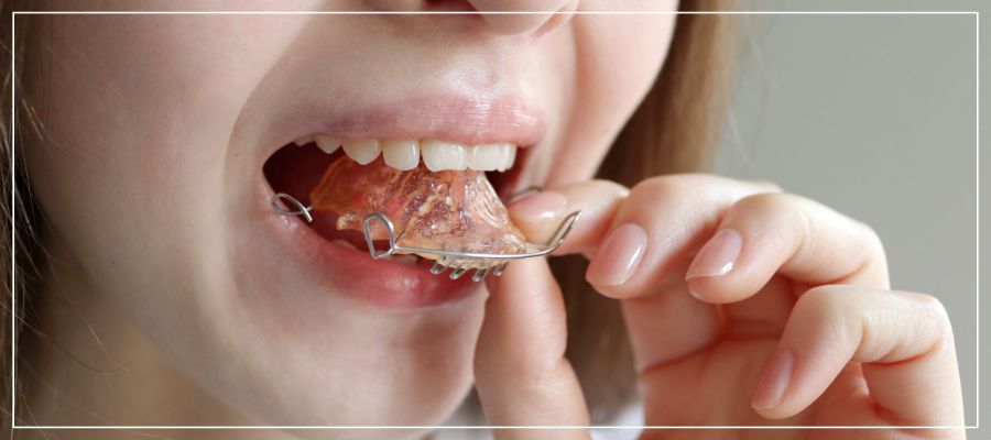 Retainer Removal Dentist in Beverly Hills, CA