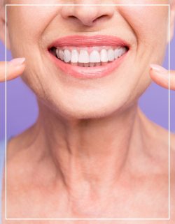 Teeth Whitening Near Me in Beverly Hills, CA